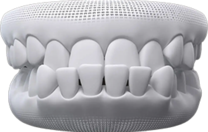 invisalign before after