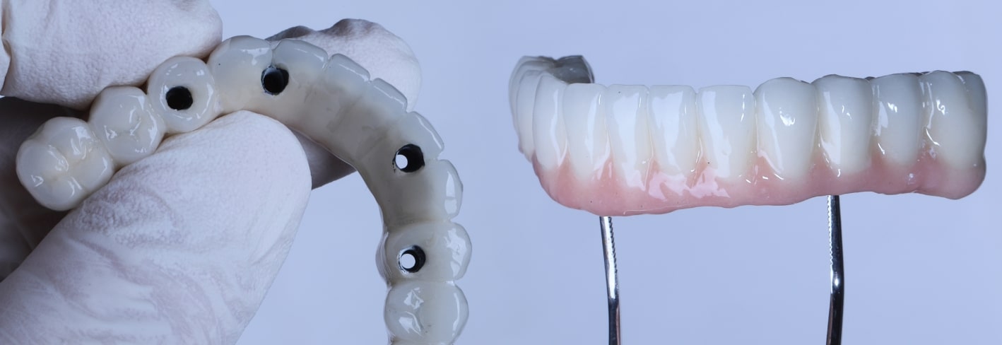 Treatment Inner Image - Haymarket Dental