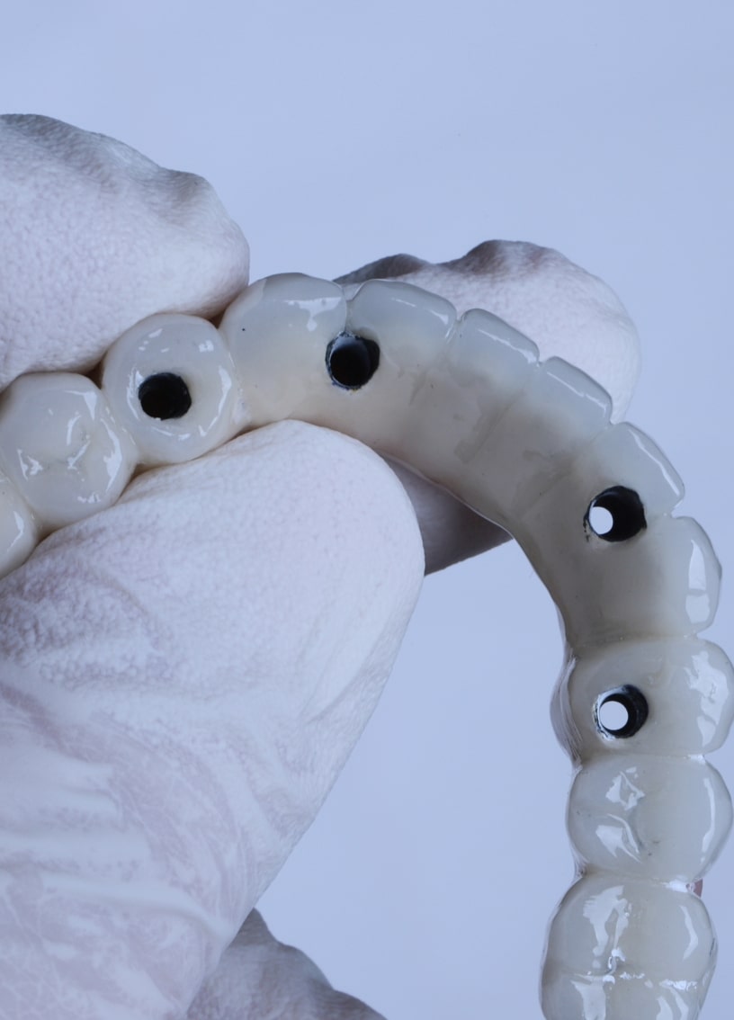 Treatment - Haymarket Dental