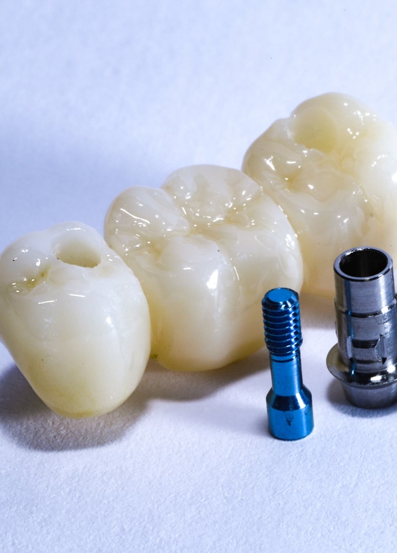 Treatment - Haymarket Dental