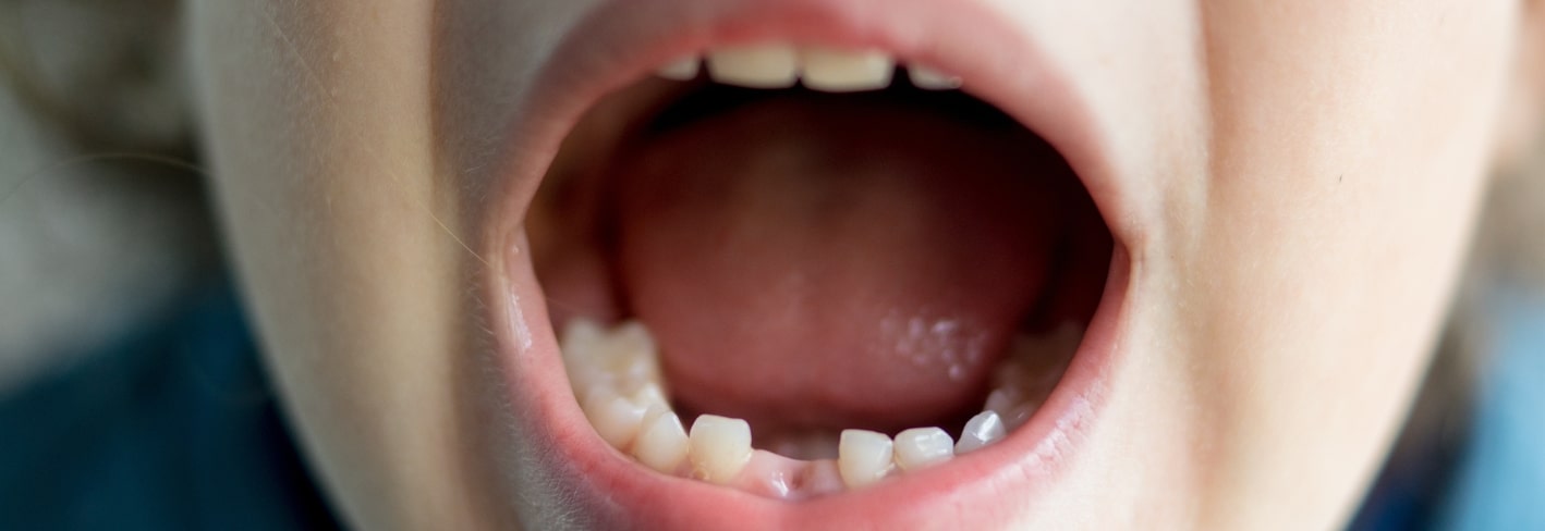 Treatment Inner Image - Haymarket Dental