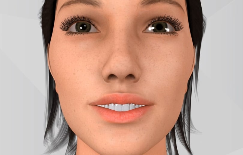 Treatment Preview Image