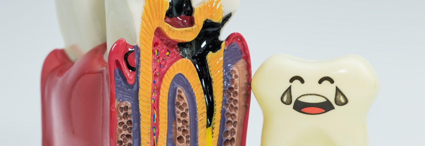 Treatment Inner Image - Haymarket Dental