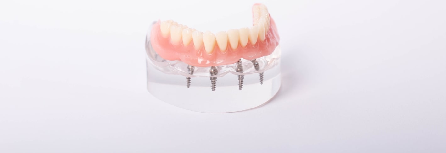 Treatment Inner Image - Haymarket Dental