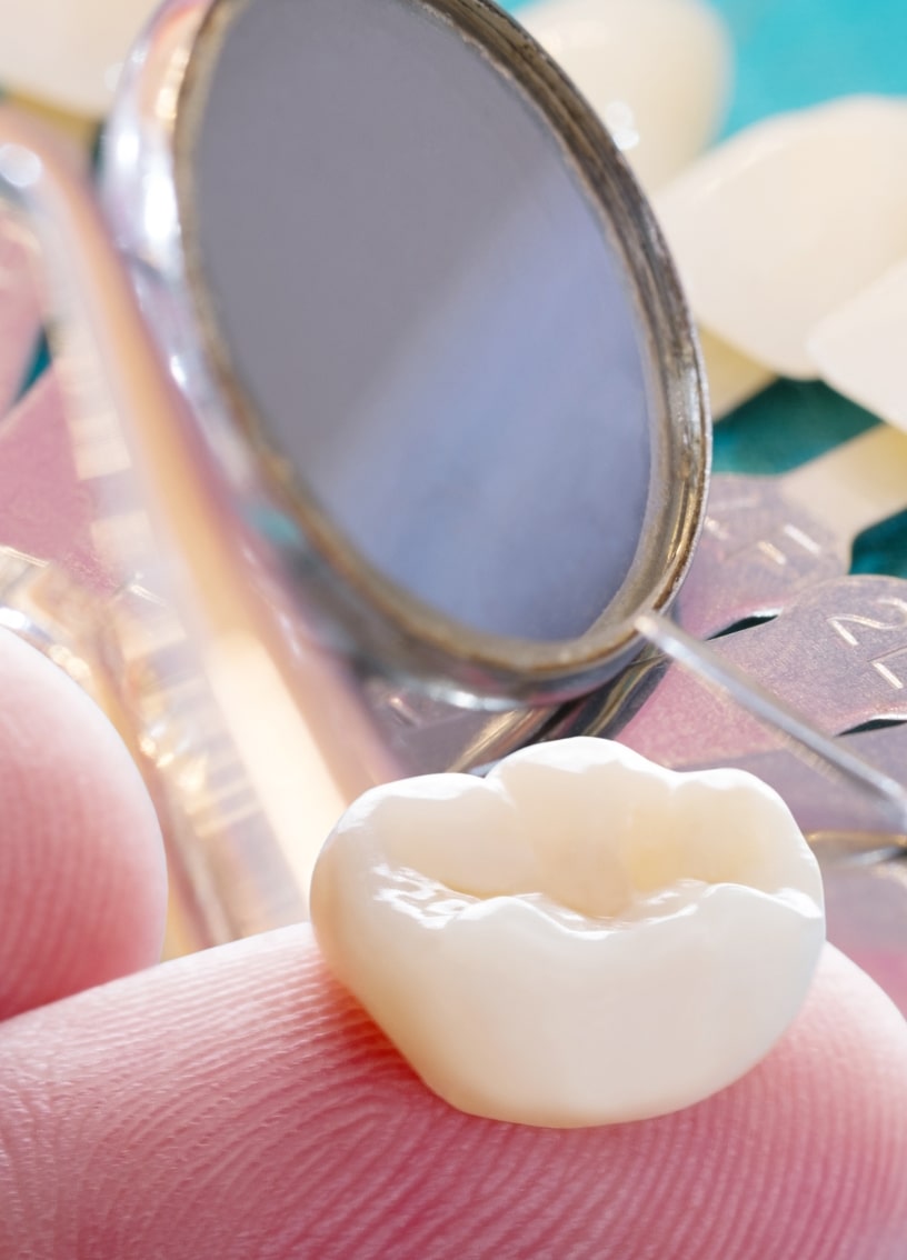 Treatment - Haymarket Dental