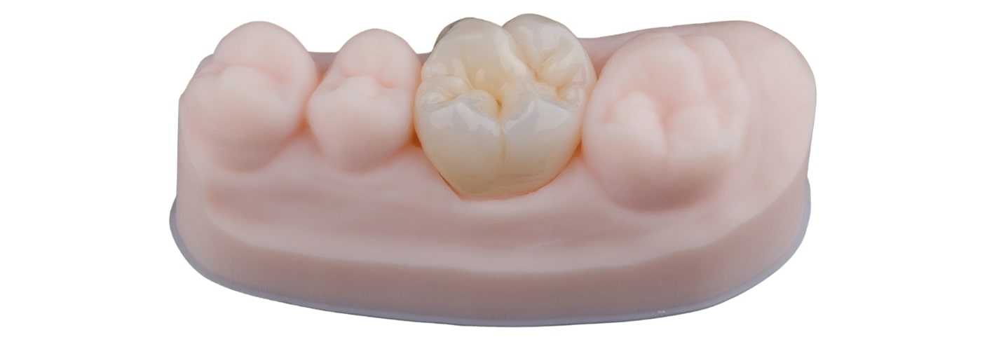 Treatment Inner Image - Haymarket Dental