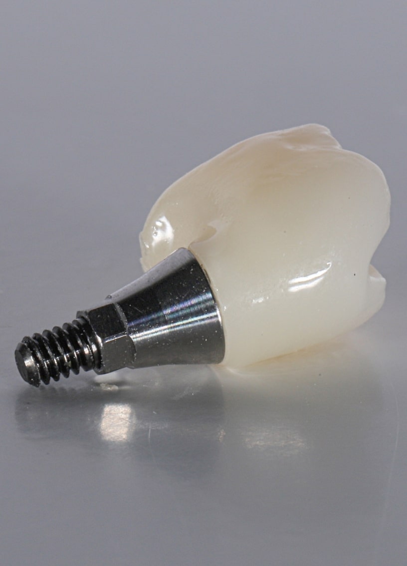 Treatment - Haymarket Dental