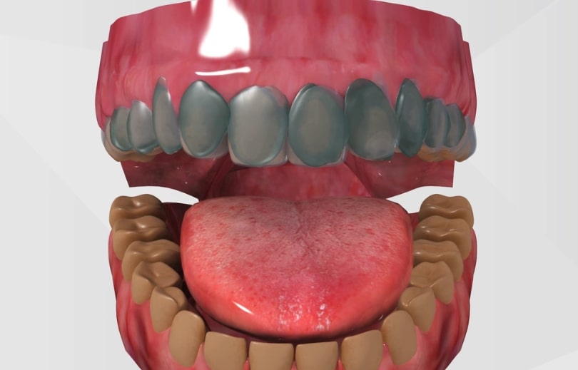 Treatment Preview Image