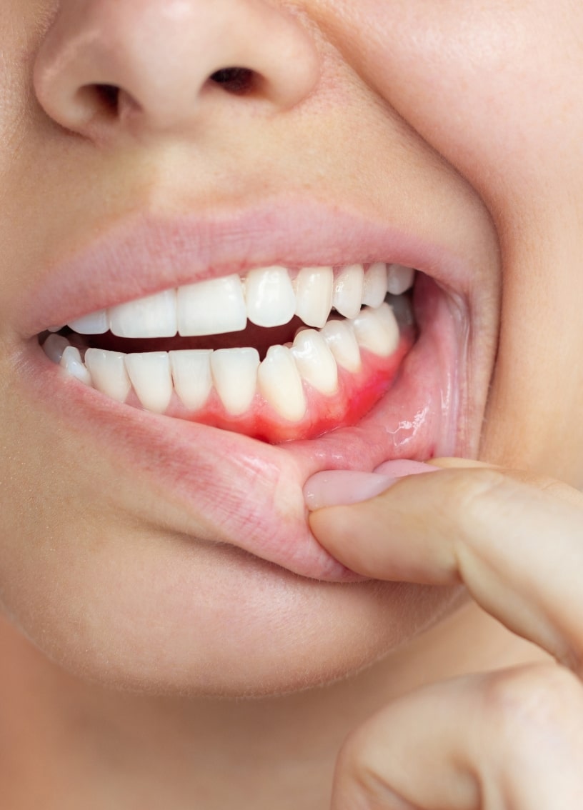 Treatment - Haymarket Dental