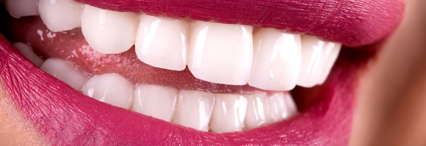 Treatment Inner Image - Haymarket Dental