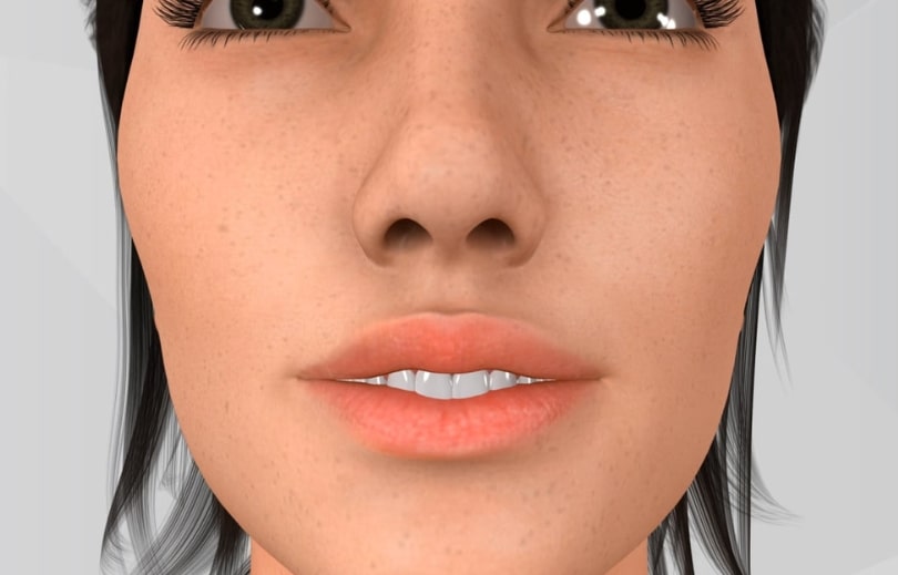 Treatment Preview Image