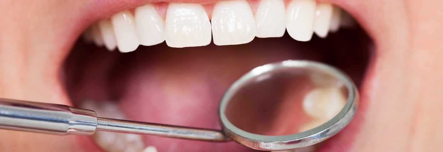 Treatment Inner Image - Haymarket Dental