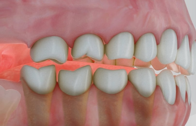 Treatment Preview Image