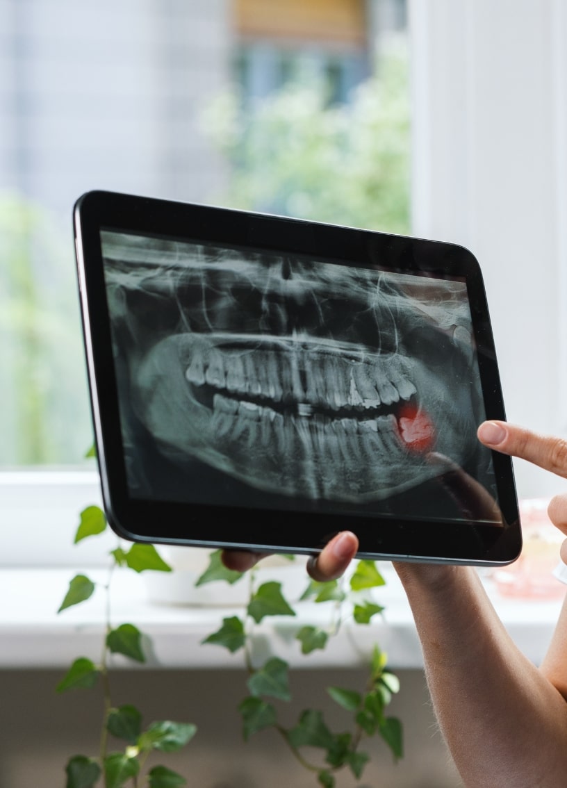 Treatment - Haymarket Dental