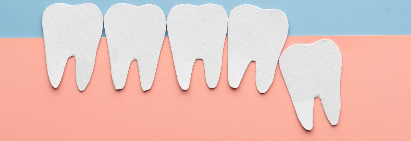 Treatment Inner Image - Haymarket Dental