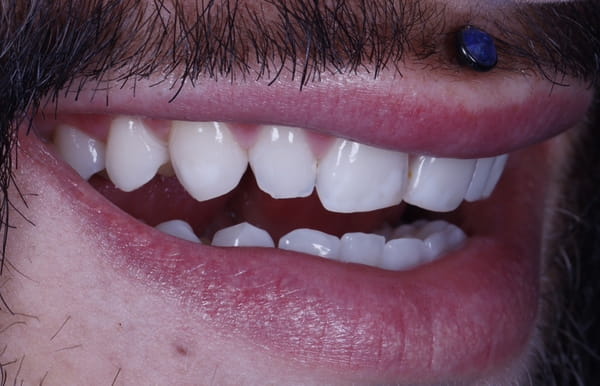 face - haymarketdentalnew