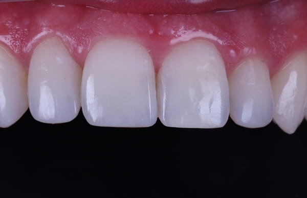 face - haymarketdentalnew