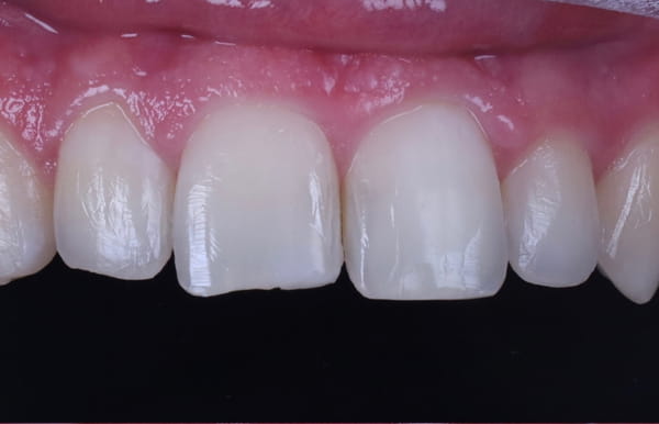 face - haymarketdentalnew