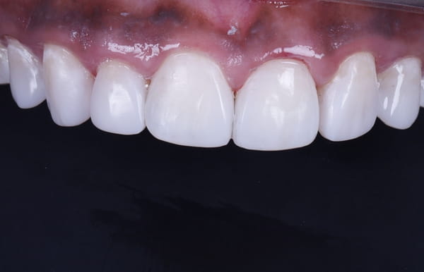 face - haymarketdentalnew