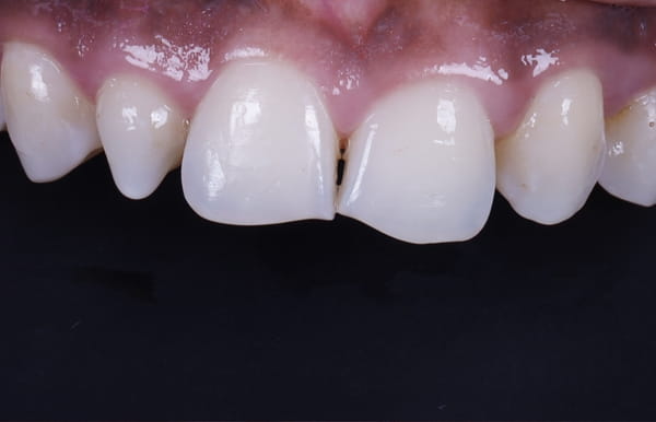 face - haymarketdentalnew