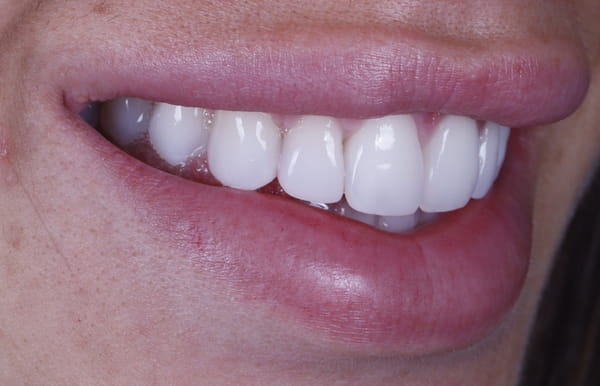 face - haymarketdentalnew