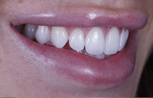 face - haymarketdentalnew