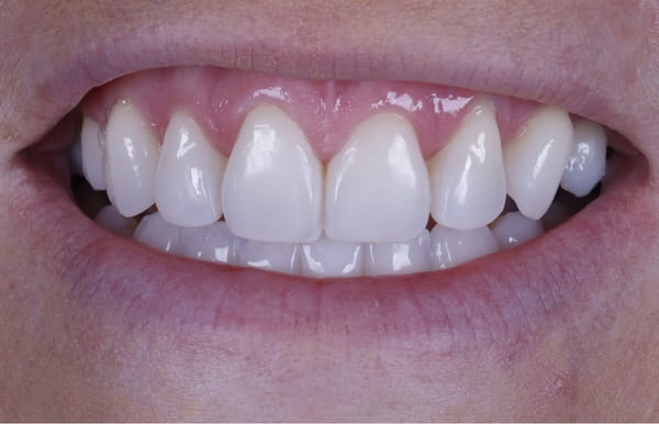face - haymarketdentalnew