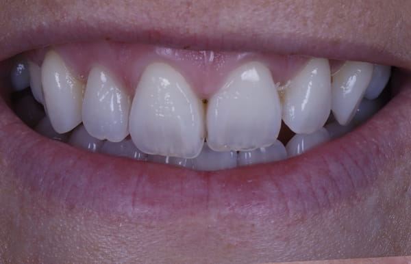 face - haymarketdentalnew