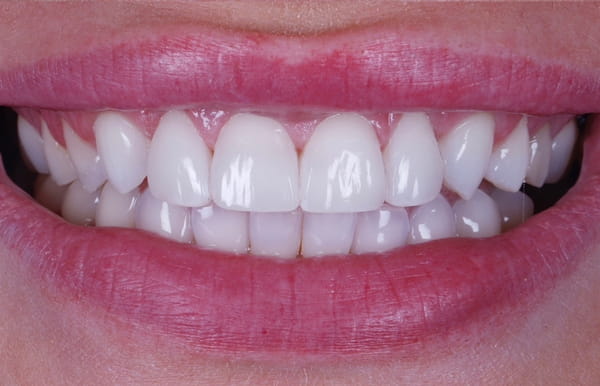 face - haymarketdentalnew