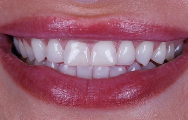 face - haymarketdentalnew