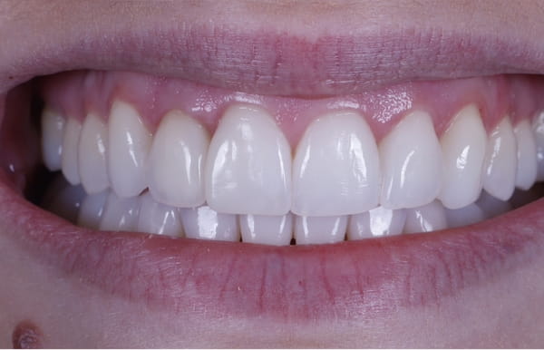 face - haymarketdentalnew