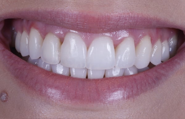 face - haymarketdentalnew