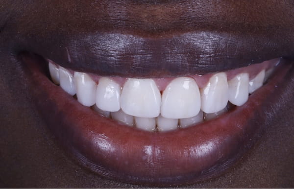 face - haymarketdentalnew