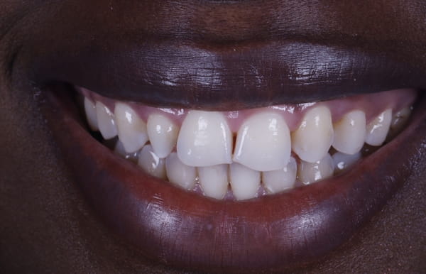 face - haymarketdentalnew