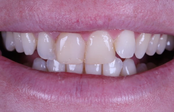 face - haymarketdentalnew