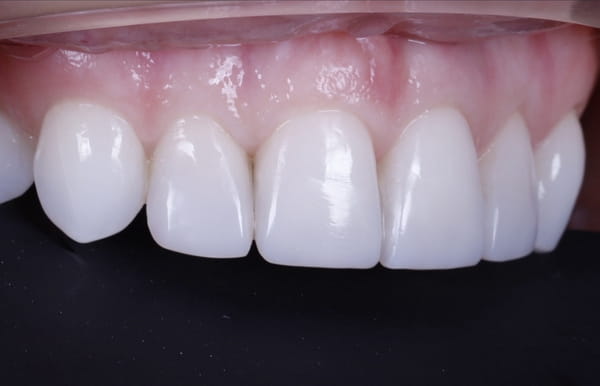 face - haymarketdentalnew