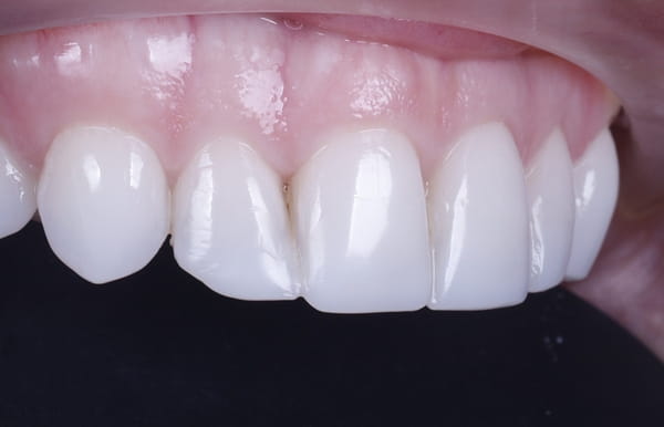 face - haymarketdentalnew