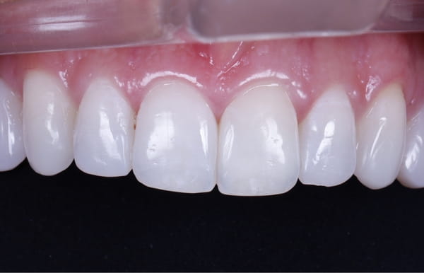 face - haymarketdentalnew