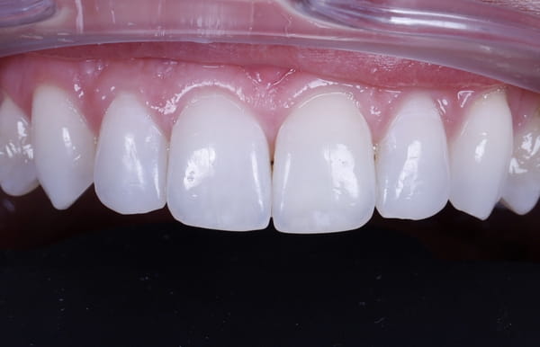 face - haymarketdentalnew