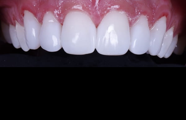 face - haymarketdentalnew