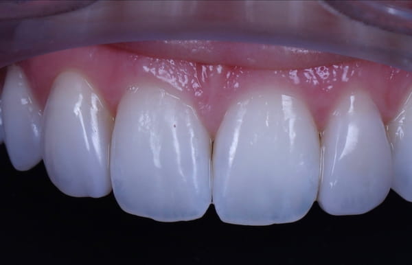 face - haymarketdentalnew