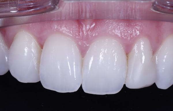 face - haymarketdentalnew