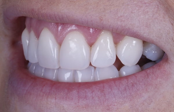 face - haymarketdentalnew