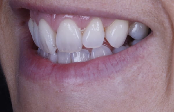 face - haymarketdentalnew