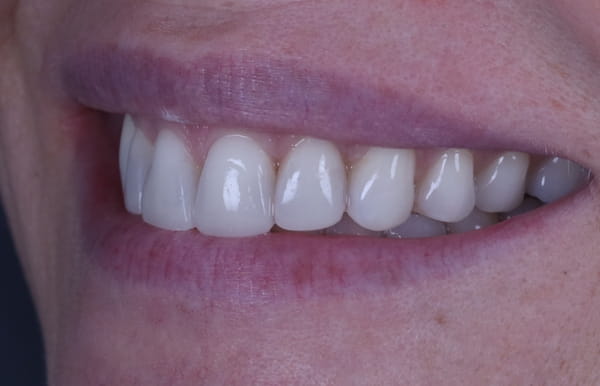 face - haymarketdentalnew