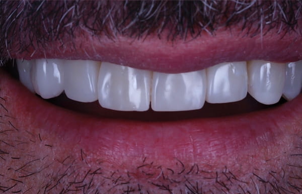 face - haymarketdentalnew