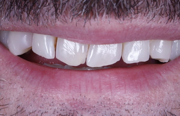 face - haymarketdentalnew