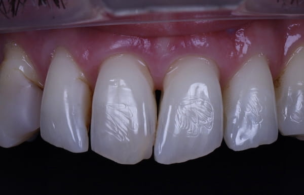 face - haymarketdentalnew
