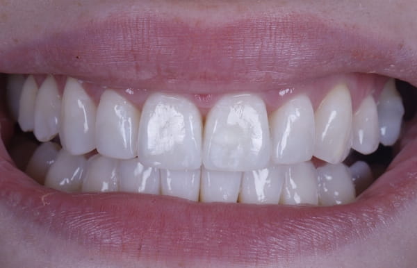 face - haymarketdentalnew