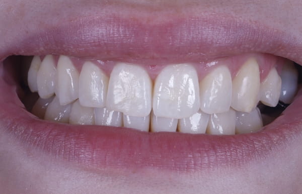 face - haymarketdentalnew